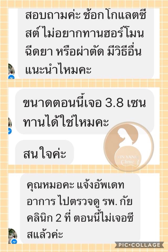 เคสช็อคโกแลตซีสต์ 3.8 ซม.แต่ไม่อยากผ่าตัด